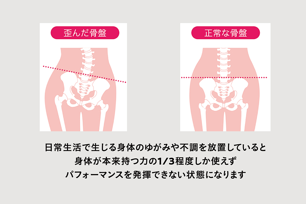 骨盤ケアイメージ