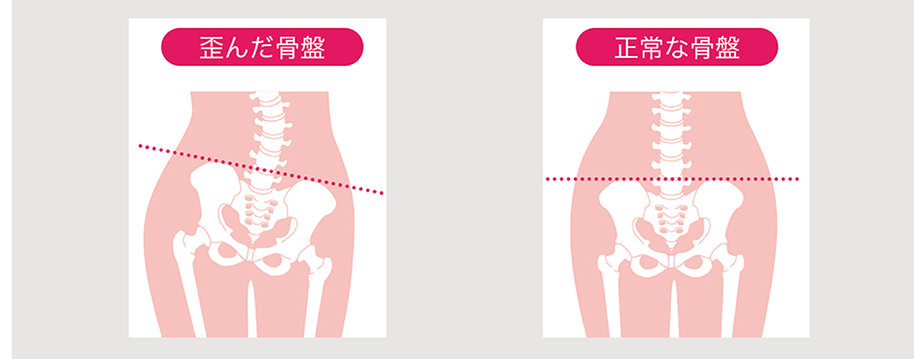 骨盤ケアイメージ