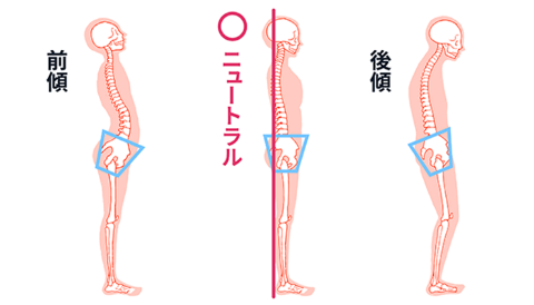 骨盤ニュートラル状態の比較図