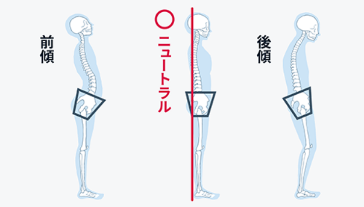 骨盤ニュートラル状態の比較図
